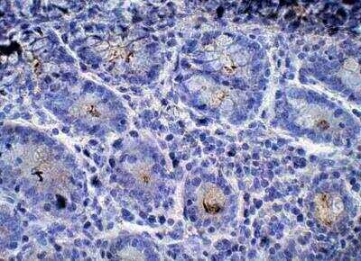 ENPP-2/Autotaxin Antibody