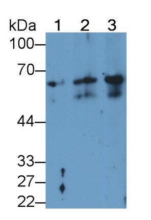 Cytokeratin 2 Antibody (D8)