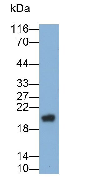 GGT1 Antibody (13#)