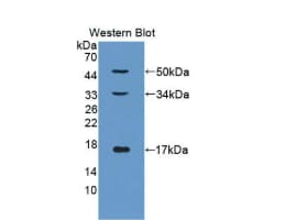Collagen X alpha 1 Antibody (D1)