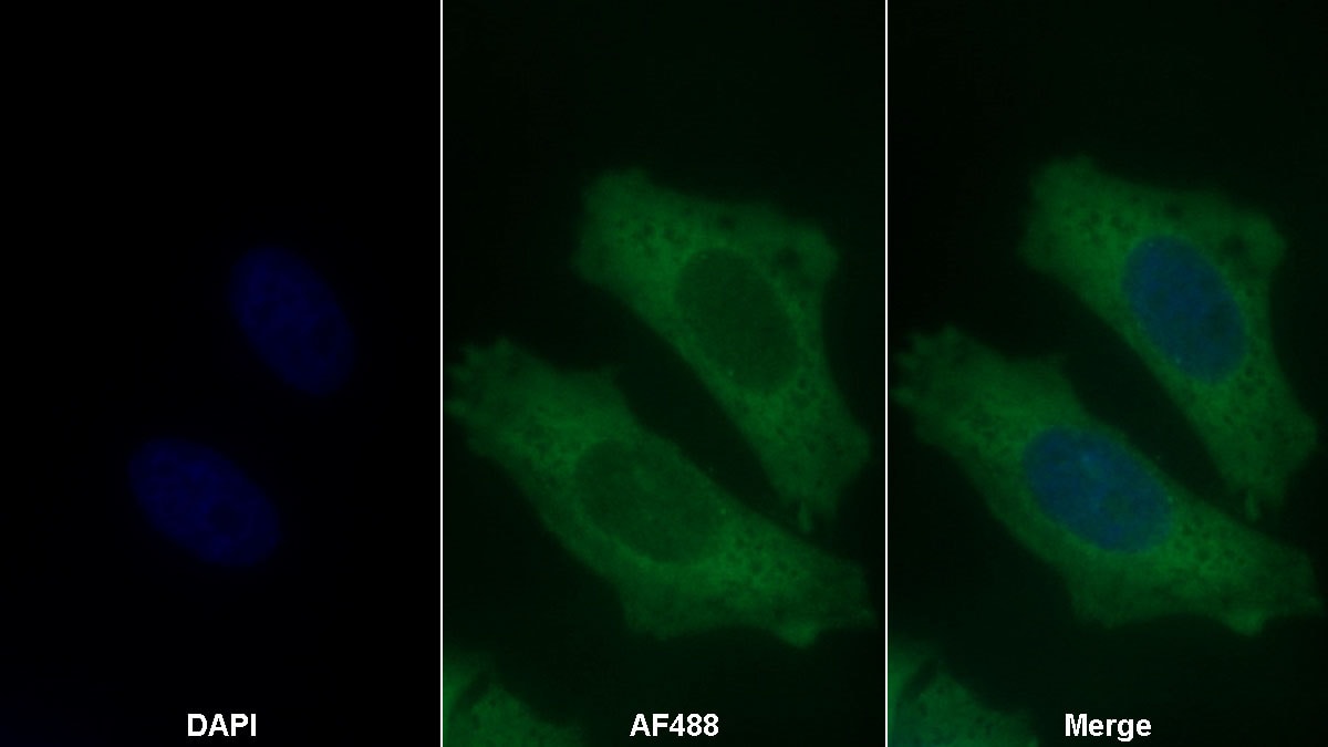 Lipolysis Stimulated Lipoprotein Receptor Antibody (D7)