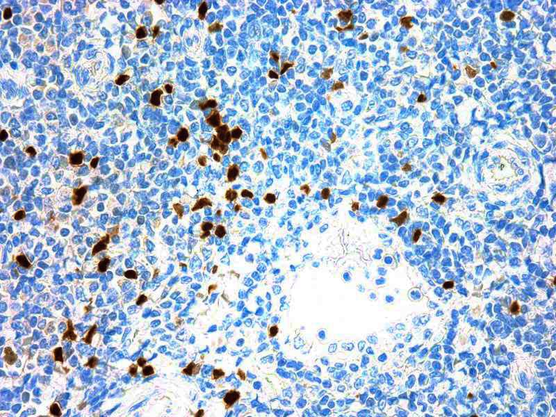 TdT Antibody (SEN 28)
