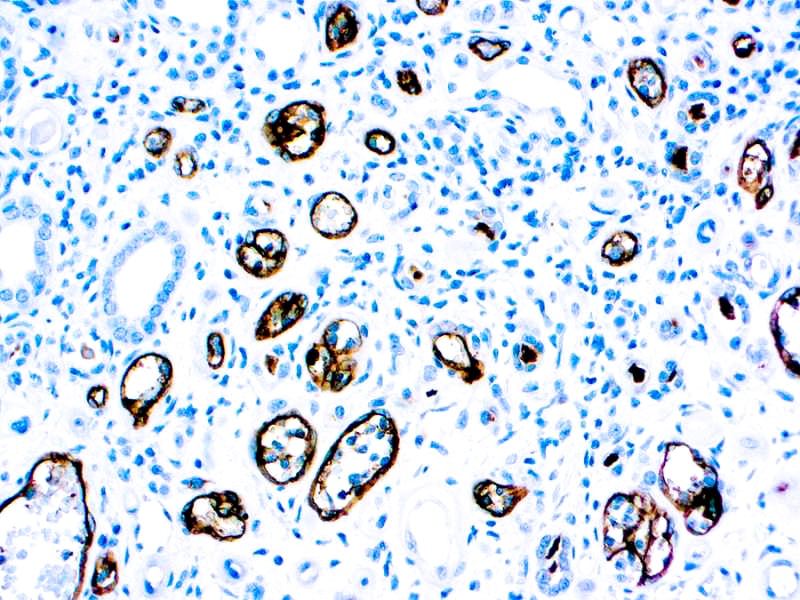 Complement C4d Antibody (C4D204)