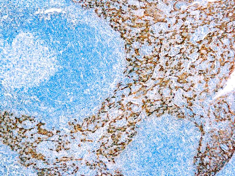 Cytokeratin 5/14 Antibody (XM26 + LL002)