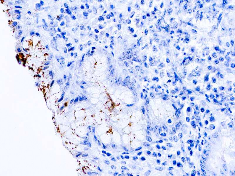 Helicobacter Pylori Antibody (DBM15.75)