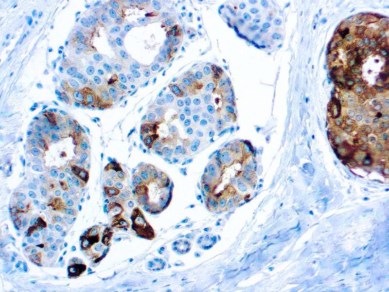 PIP Antibody (DBM15.52)