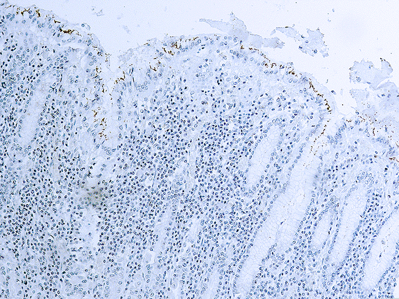 Helicobacter Pylori Antibody
