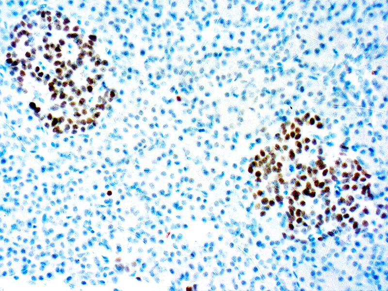 INSM1 Antibody (A-8)