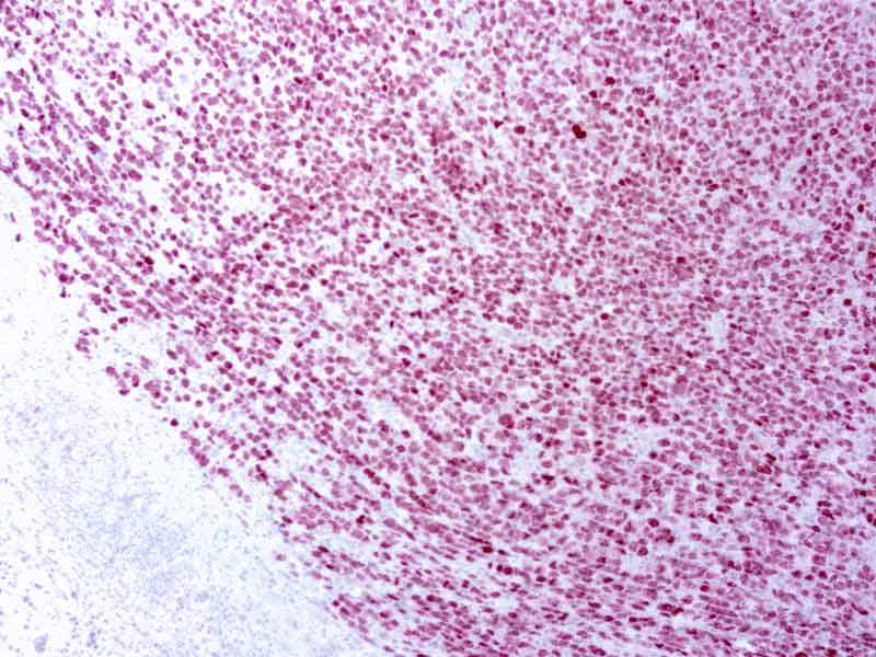 PRAME Antibody (EPR20330)