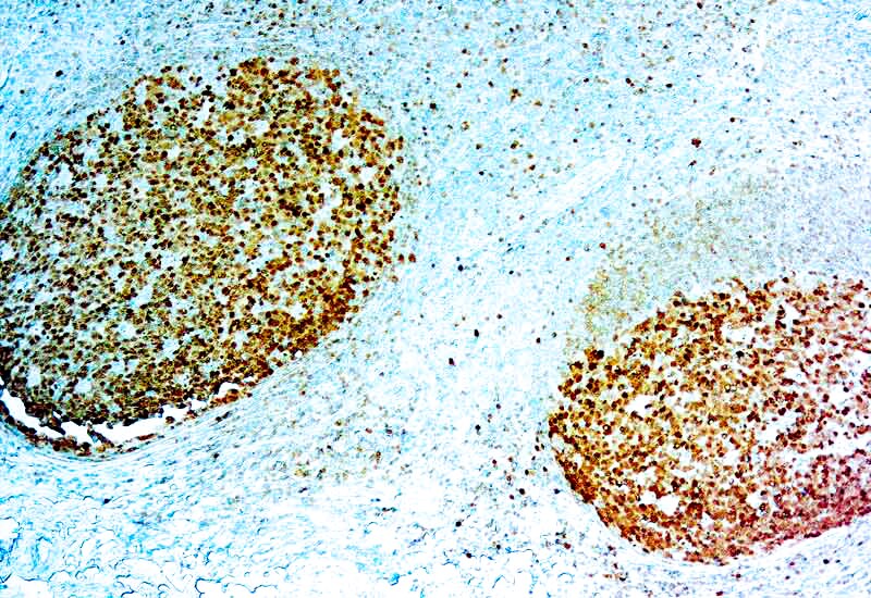BOB1 Antibody (SP92)