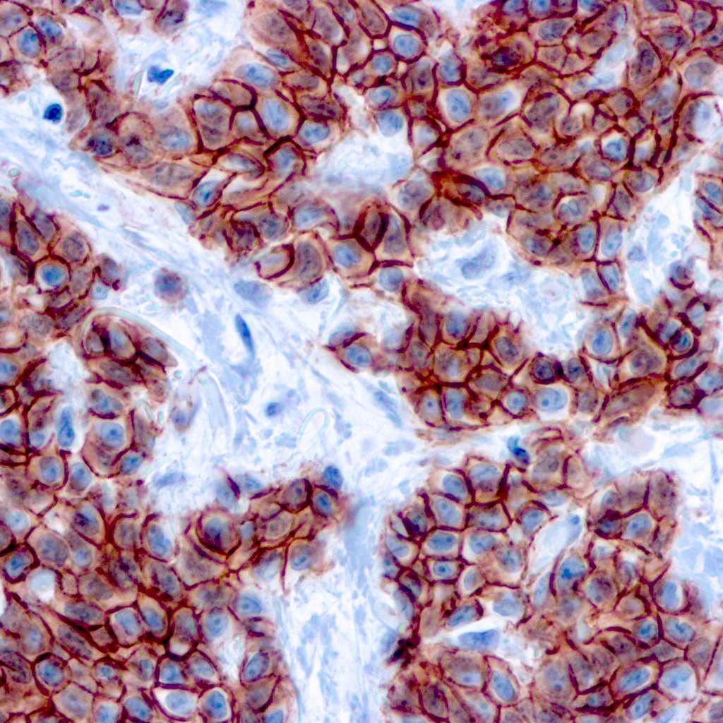 p120-catenin Antibody (DBM15.55)