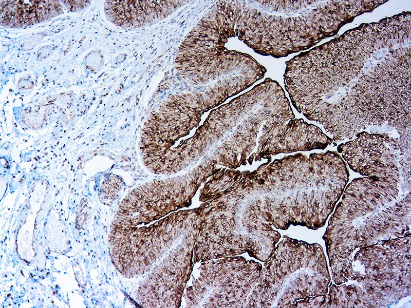 Uroplakin III Antibody (AU1)