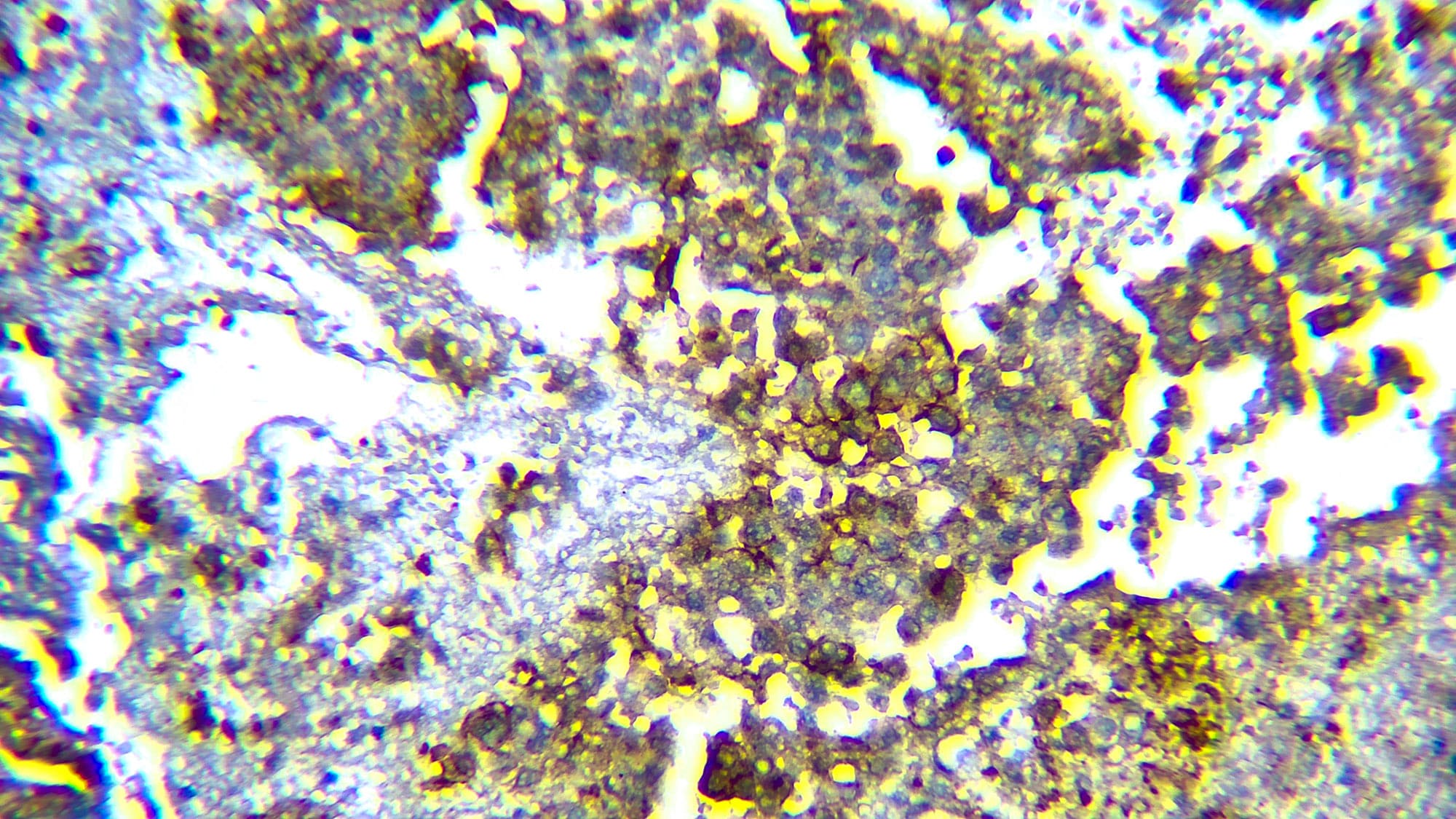 Uroplakin IIIB Antibody (DBRRM3.66)