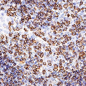 DEP-1/CD148 Antibody (A3) Detection of CD148 in Human Tonsil.