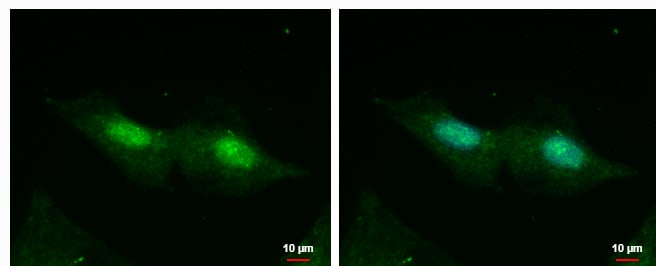 RADX Antibody