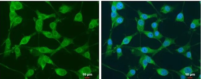 NEK1 Antibody