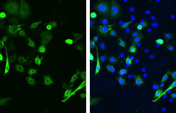 SARS Spike Protein Antibody (1A9)