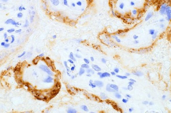 SARS Spike Protein Antibody (1A9)