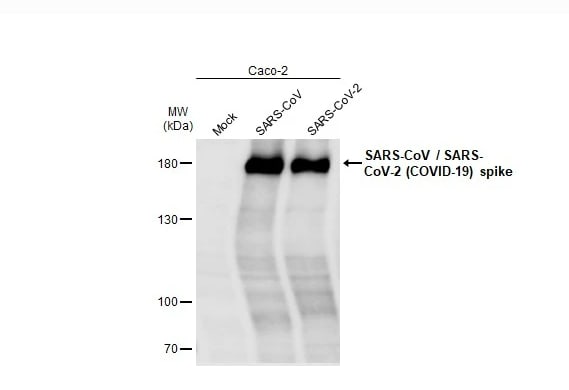 SARS Spike Protein Antibody (1A9)