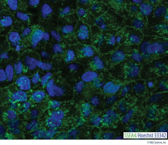 Detection of SSEA-4 in Live BG01V Human Embryonic Stem Cells.