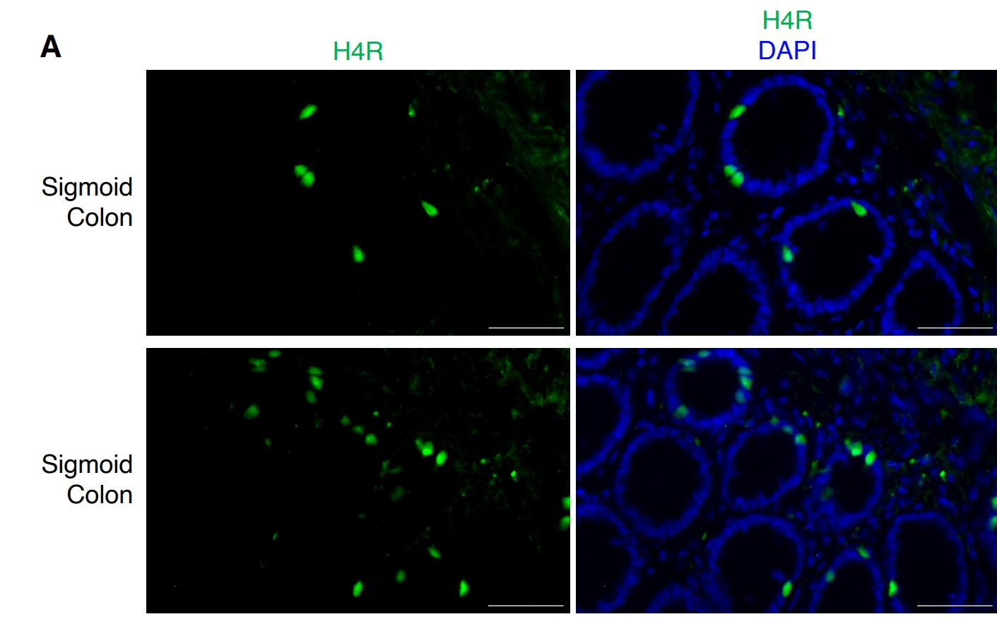 Histamine H4R Antibody - BSA Free