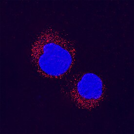 p38 beta /MAPK11 antibody in Jurkat Human Cell Line by Immunocytochemistry (ICC).