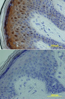 p38d antibody in Human Skin by Immunohistochemistry (IHC-P).