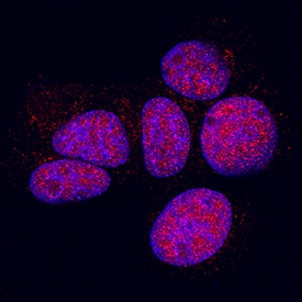 p38? antibody in MCF-7 Human Cell Line by Immunocytochemistry (ICC).