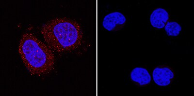 p38? antibody in MCF-7 and MOLT-4 Human Cell Lines by Immunocytochemistry (ICC).