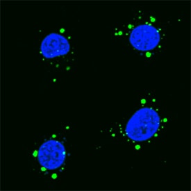 p62/SQSTM1 antibody in RAW 264 by Immunocytochemistry (ICC).7 Mouse Cell Line by Immunocytochemistry (ICC).