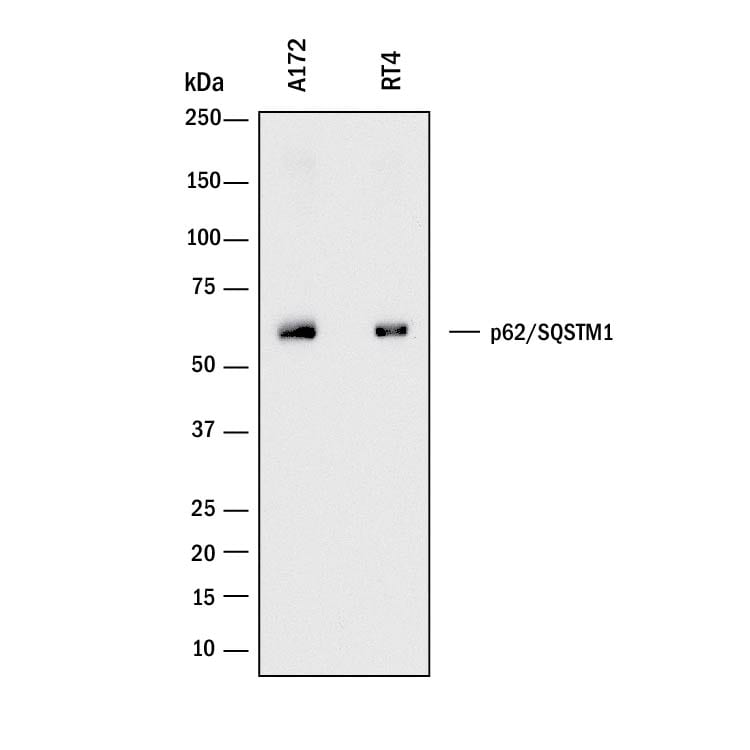 Detection of Human p62/SQSTM1 antibody by Western Blot.