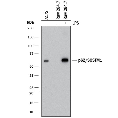 Detection of Human and Mouse p62/SQSTM1 antibody by Western Blot.