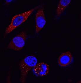 p62/SQSTM1 antibody in HeLa Human Cell Line by Immunocytochemistry (ICC).