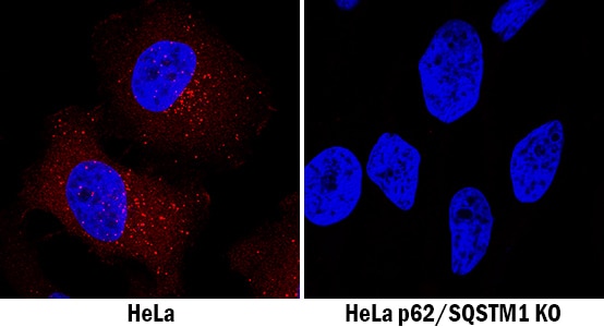 p62/SQSTM1 Antibody Specificity is Shown by Immunocytochemistry antibody in Knockout Cell Line.