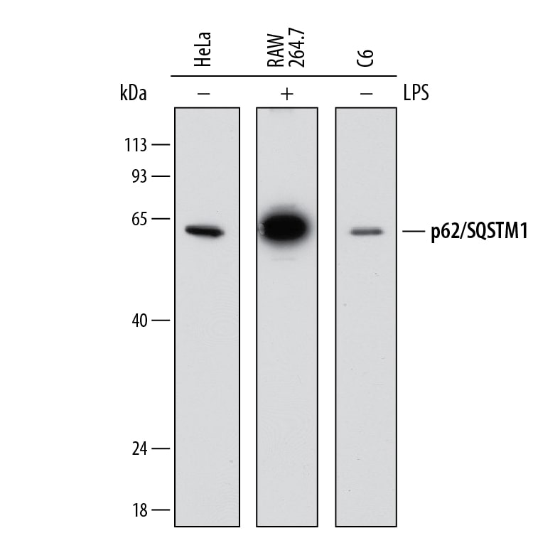 Detection of Human, Mouse, and Rat p62/SQSTM1 antibody by Western Blot.