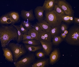 p63/TP73L antibody in SCC-25 Human Cell Line by Immunocytochemistry (ICC).