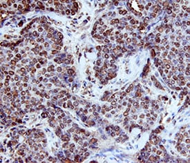 p63/TP73L antibody in Human Breast by Immunohistochemistry (IHC-P).