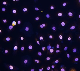 p63/TP73L antibody in SCC-25 Human Cell Line by Immunocytochemistry (ICC).