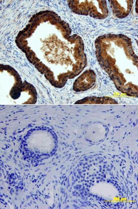 p63/TP73L antibody in Human Prostate by Immunohistochemistry (IHC-P).