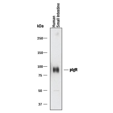 Detection of Human pIgR antibody by Western Blot.