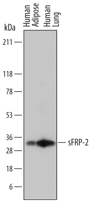 Detection of Human sFRP-2 antibody by Western Blot.