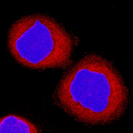 sFRP-1 antibody in MBA-MB-468 Human Cell Line by Immunocytochemistry (ICC).