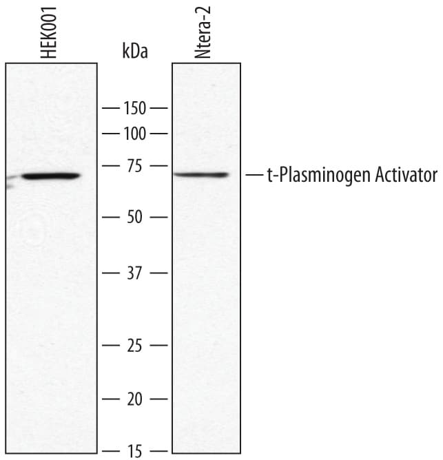 Detection of Human t-Plasminogen Activator/tPA antibody by Western Blot.