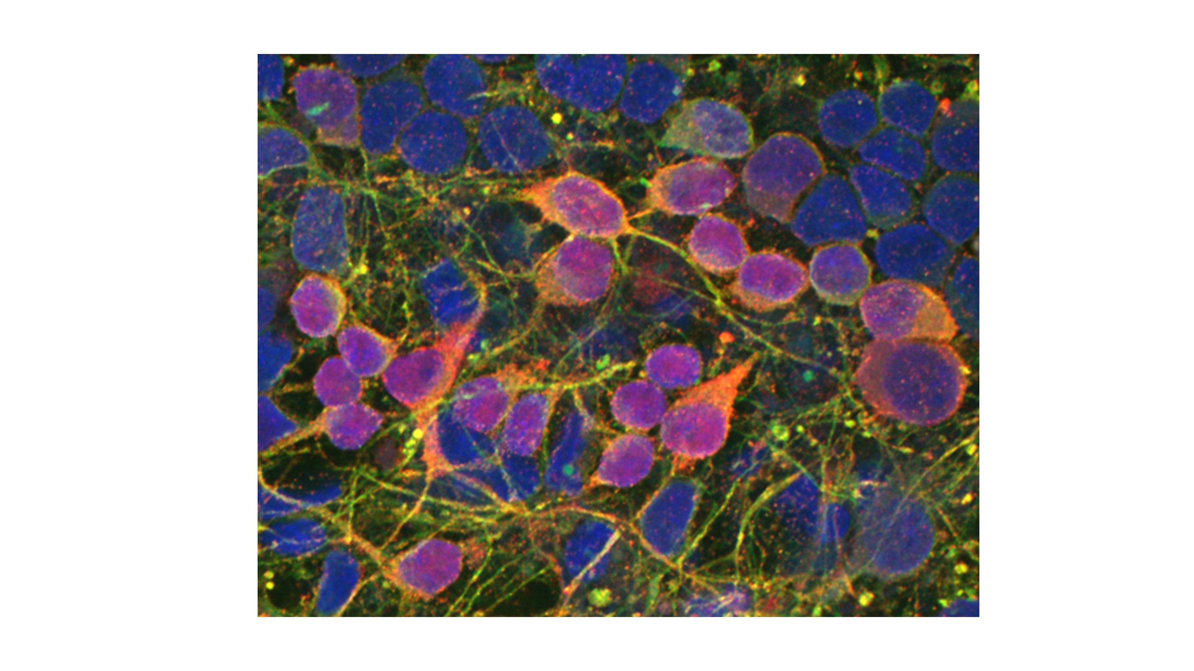 GMP N-2 MAX Dopaminergic Neuron_TuJ_TH_DAPI
