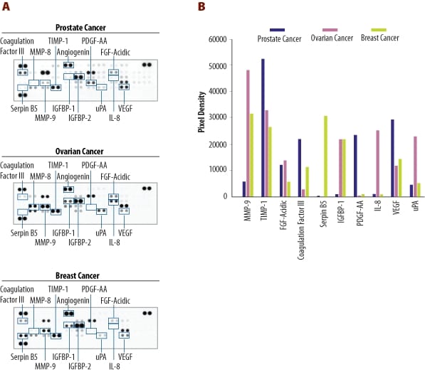 Profiling Angiogenesis-Related Proteins in Human Cancer Tissues.