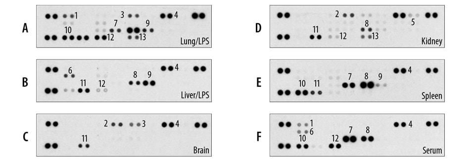 The Rat Cytokine Array detects multiple analytes in tissue lysates and serum.