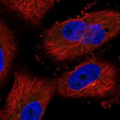 Immunocytochemistry/ Immunofluorescence: aurora A-binding protein Antibody [NBP1-81152]