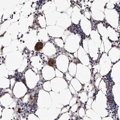 Immunohistochemistry-Paraffin: aurora A-binding protein Antibody [NBP1-81152]