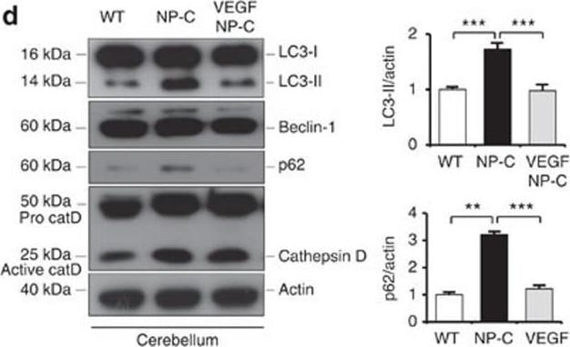 Detection of Mouse Cathepsin D by Western Blot