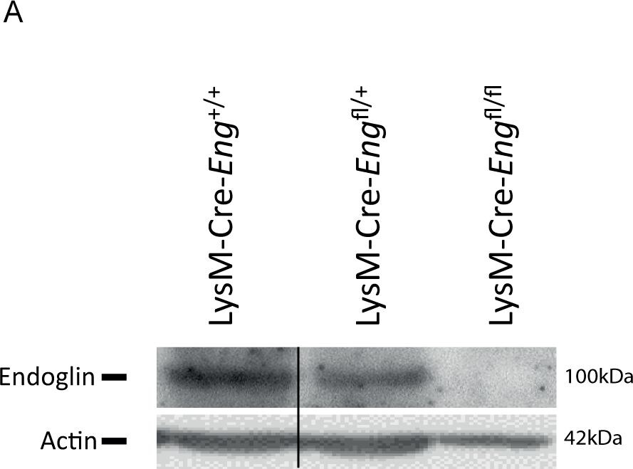 Detection of Mouse Endoglin/CD105 by Western Blot